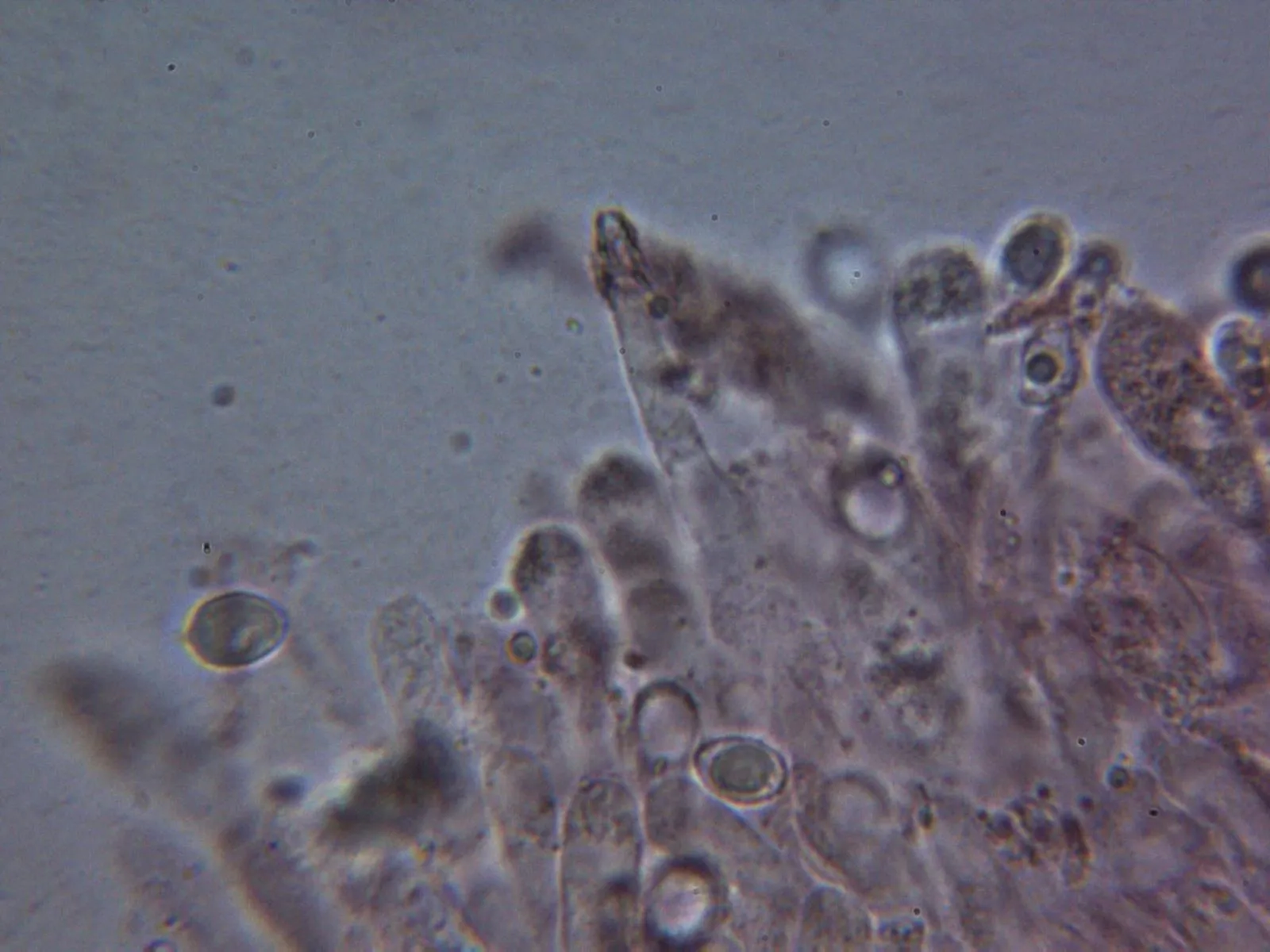 Microscopía de Melanoleuca exscissa - 10 - Queilocistidio septado